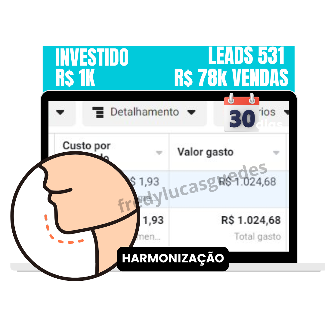 Harmonização Facial